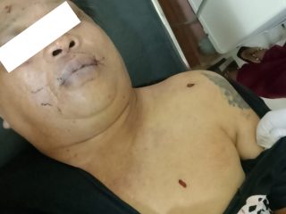 Malam berdarah Di Motoling, Frangky Tompodung Tewas di Tangan Kevin Paat